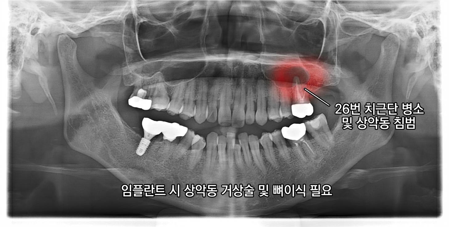 초진 엑스레이