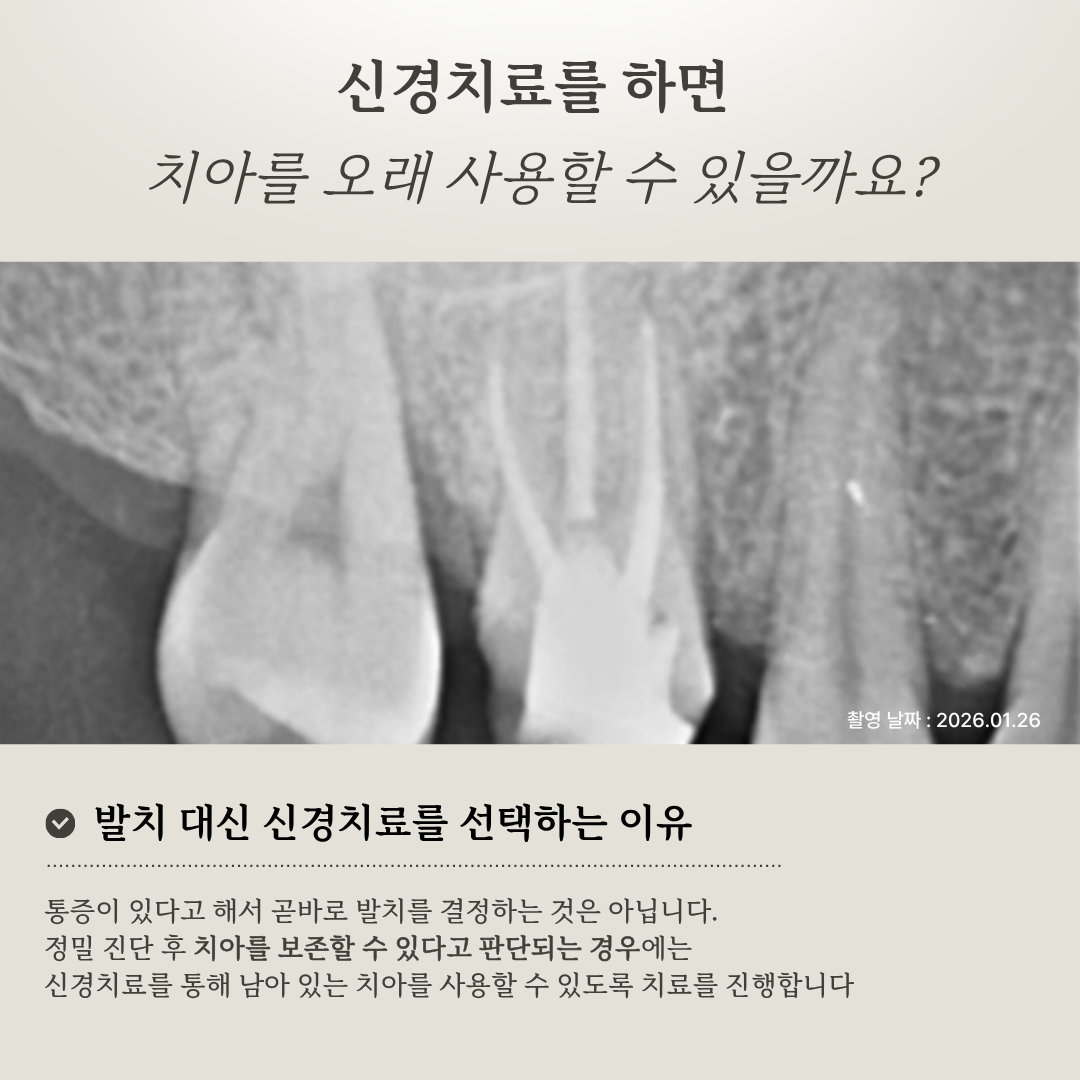 신경치료를 하면 치아를 오래 사용할 수 있을까요?