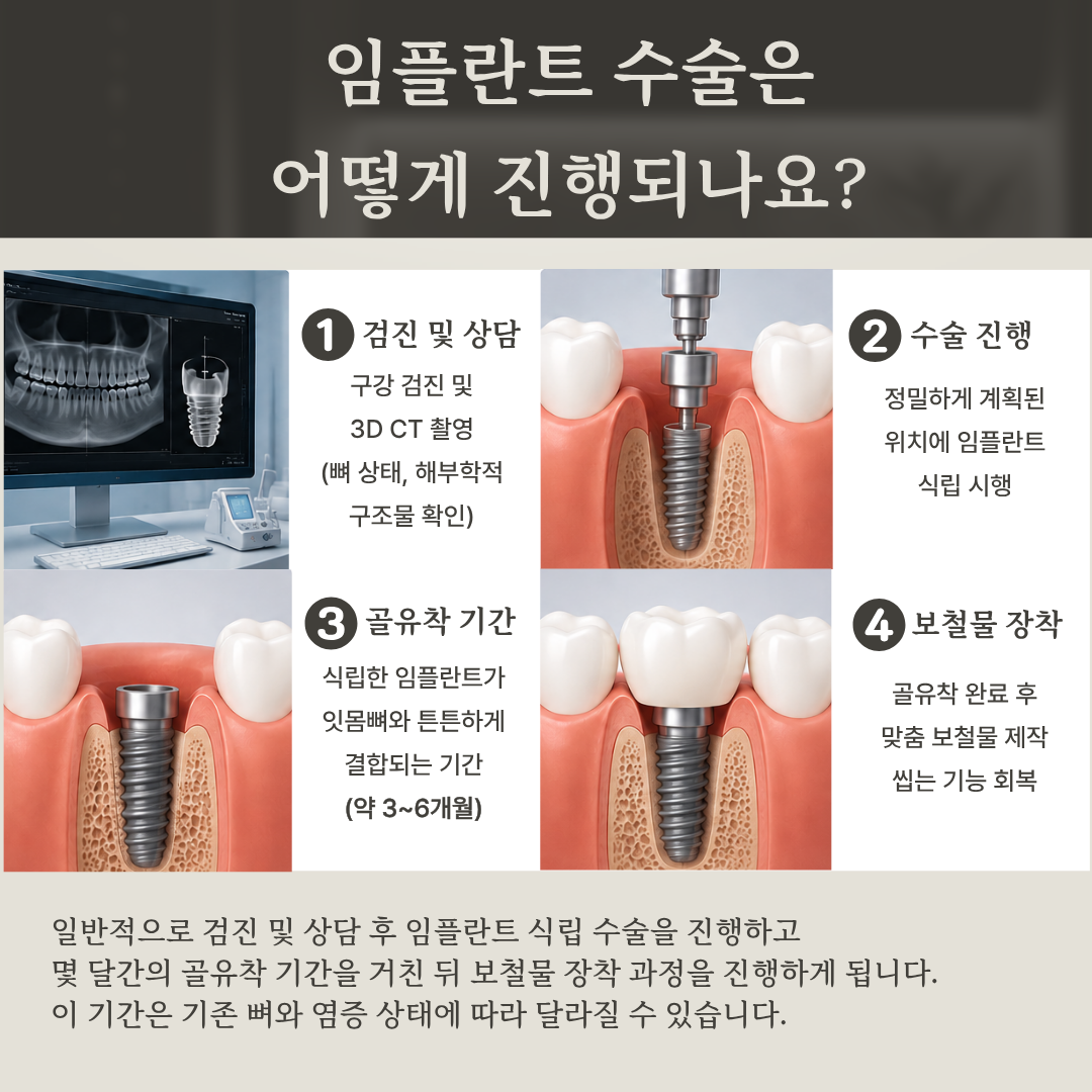 검사부터 최종 보철까지 임플란트 치료의 전체 과정