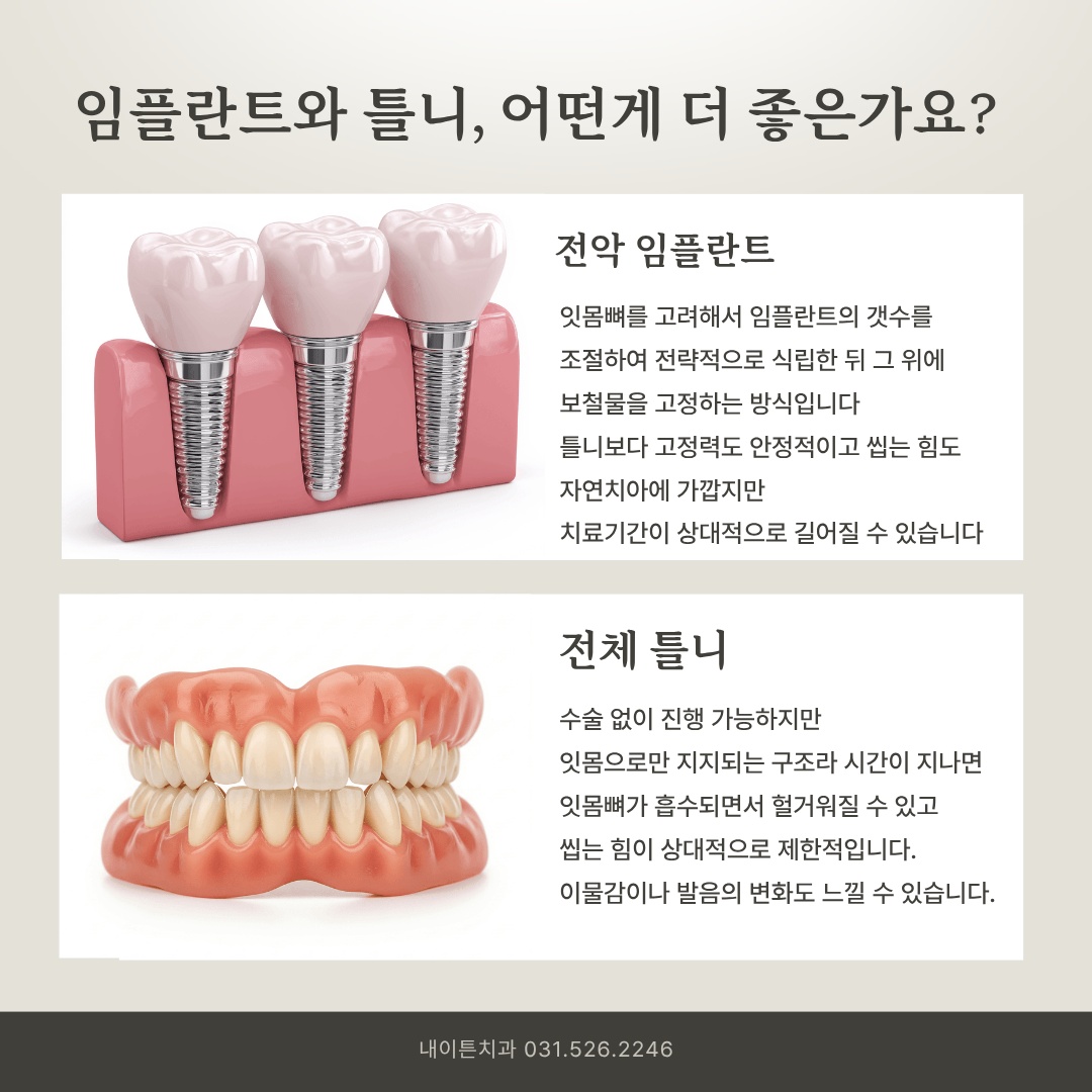 전악 임플란트와 전체 틀니 구조 비교 일러스트