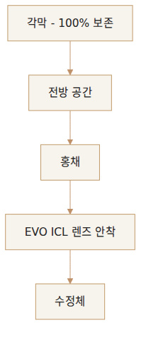 ICL 렌즈가 안착되는 눈 속 위치