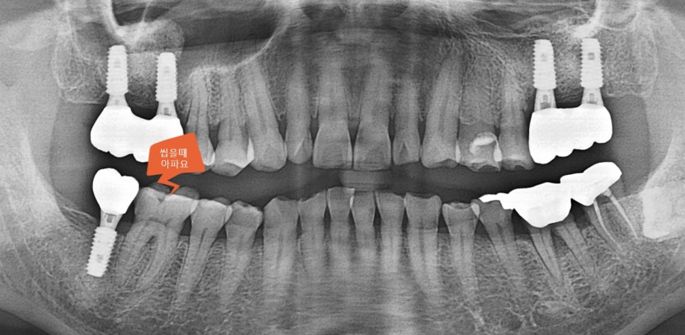 Treatment case image 1