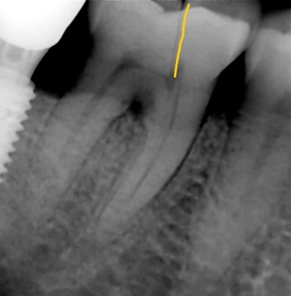 Treatment case image 2