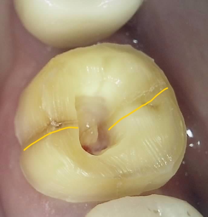Treatment case image 3