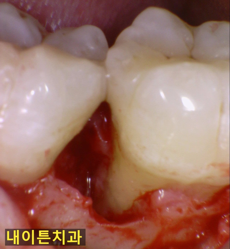 Treatment case image 3