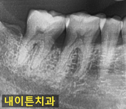 Treatment case image 7