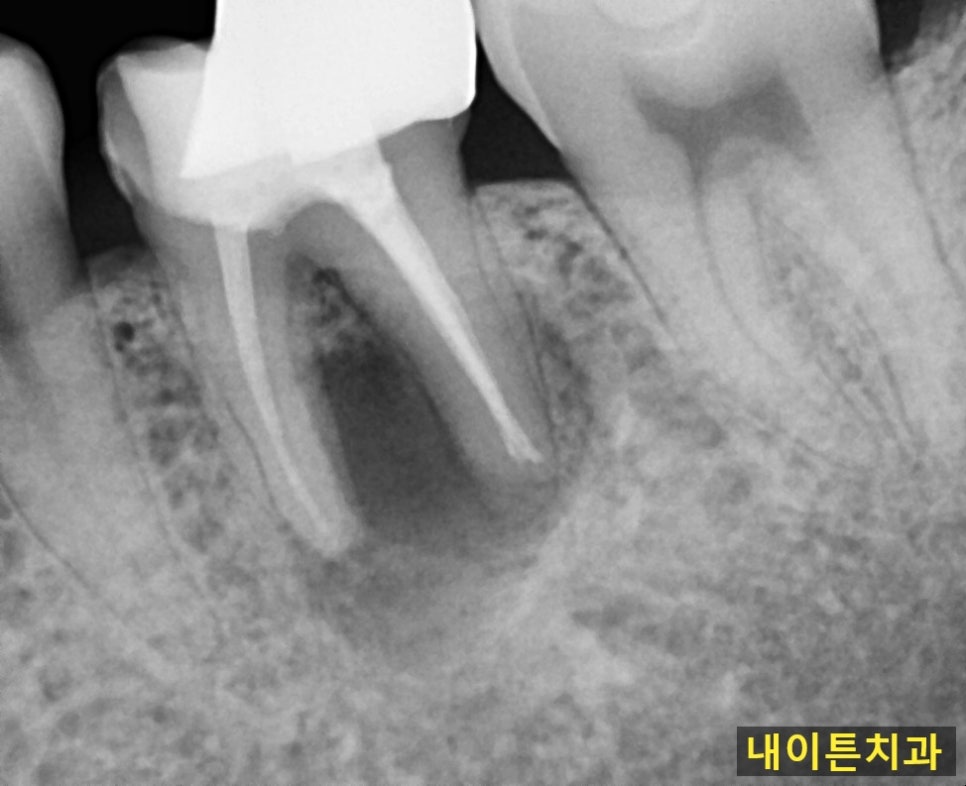 Treatment case image 1