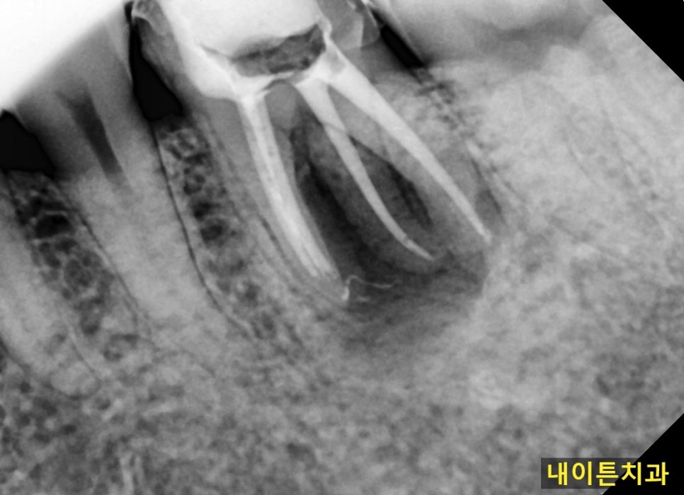 Treatment case image 3