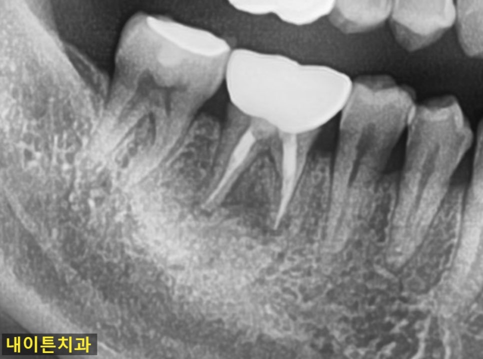 Treatment case image 3