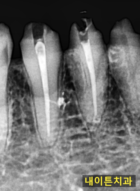 Treatment case image 1