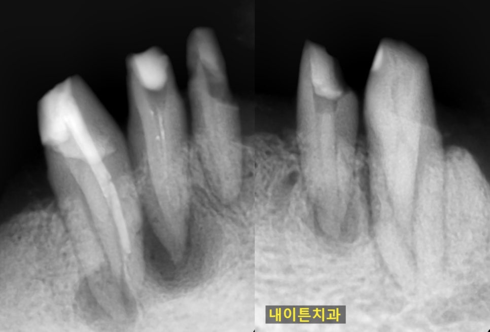 Treatment case image 3