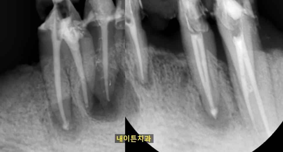 Treatment case image 4