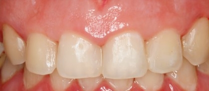 Treatment case image 3