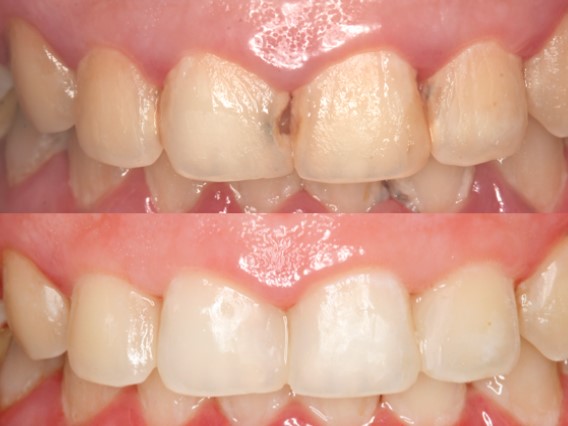 Treatment case image 5