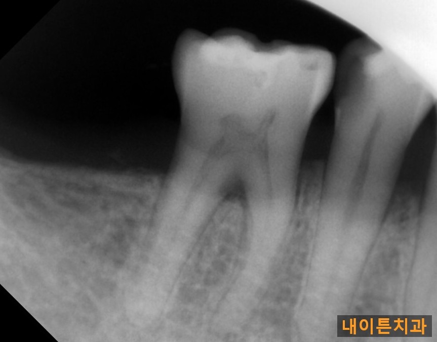 Treatment case image 1