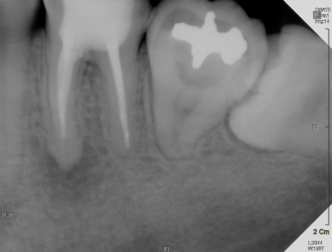 Treatment case image 1