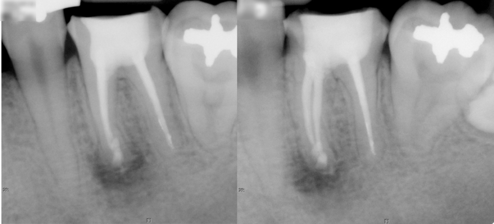 Treatment case image 3