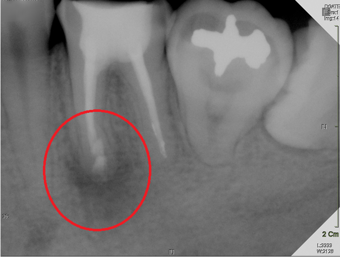 Treatment case image 4