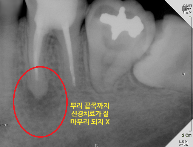 Treatment case image 5