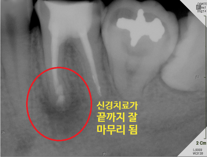 Treatment case image 6