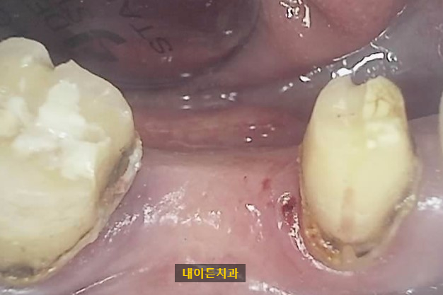 Treatment case image 3
