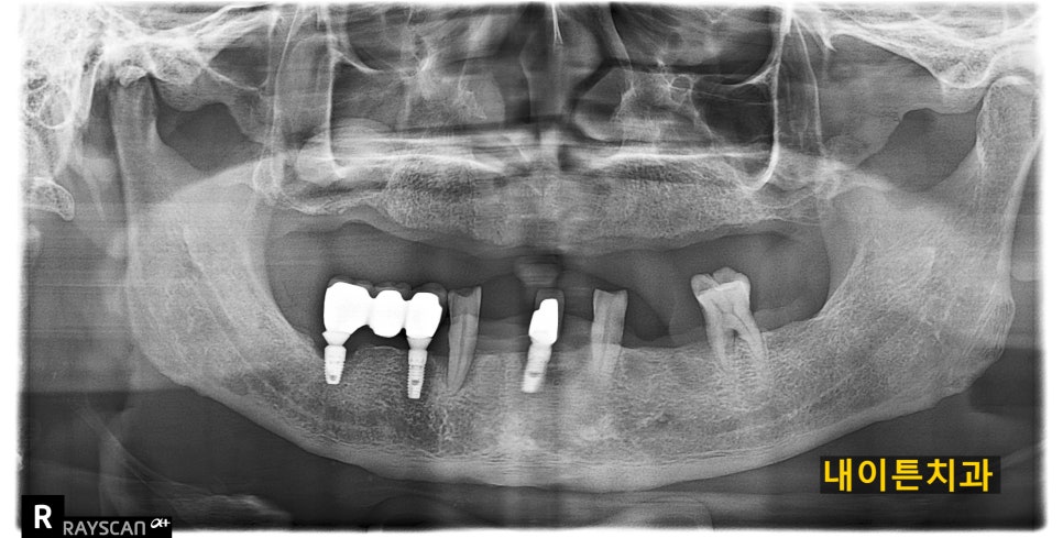 Treatment case image 1