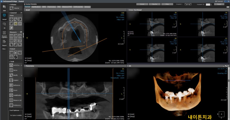 Treatment case image 2