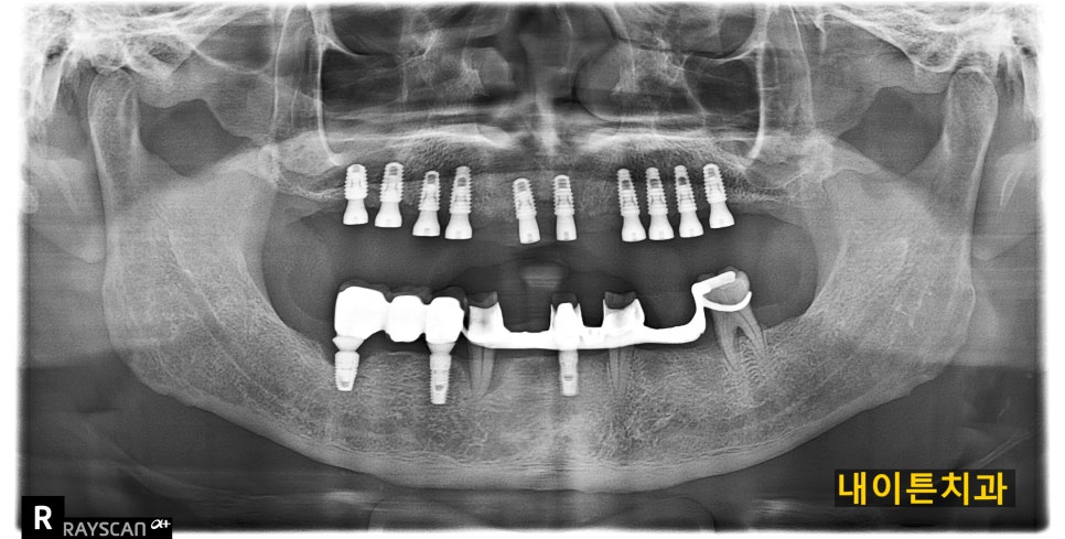 Treatment case image 4