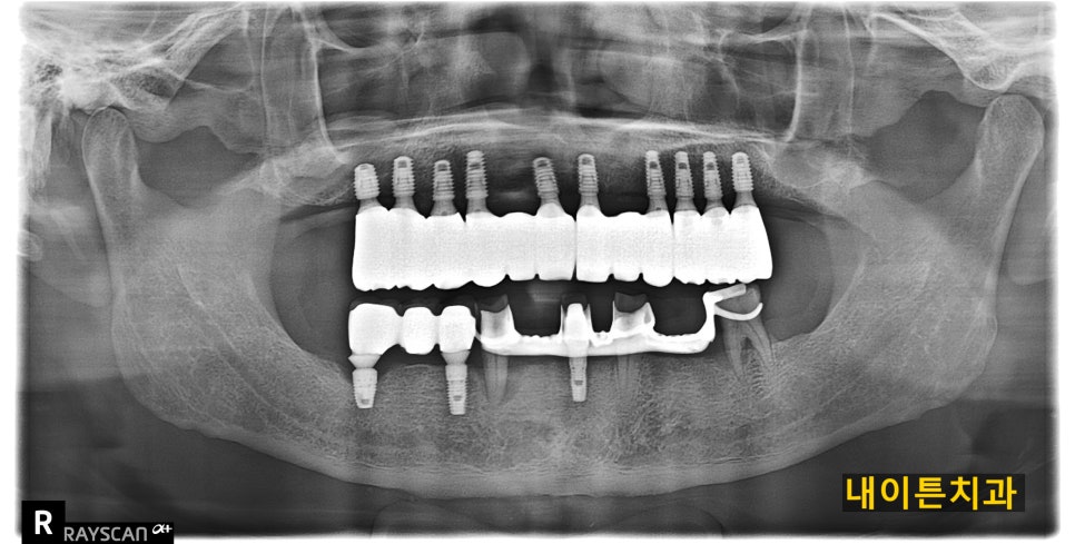 Treatment case image 5
