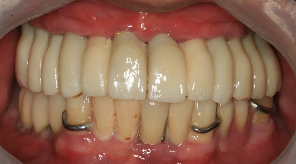 Treatment case image 6