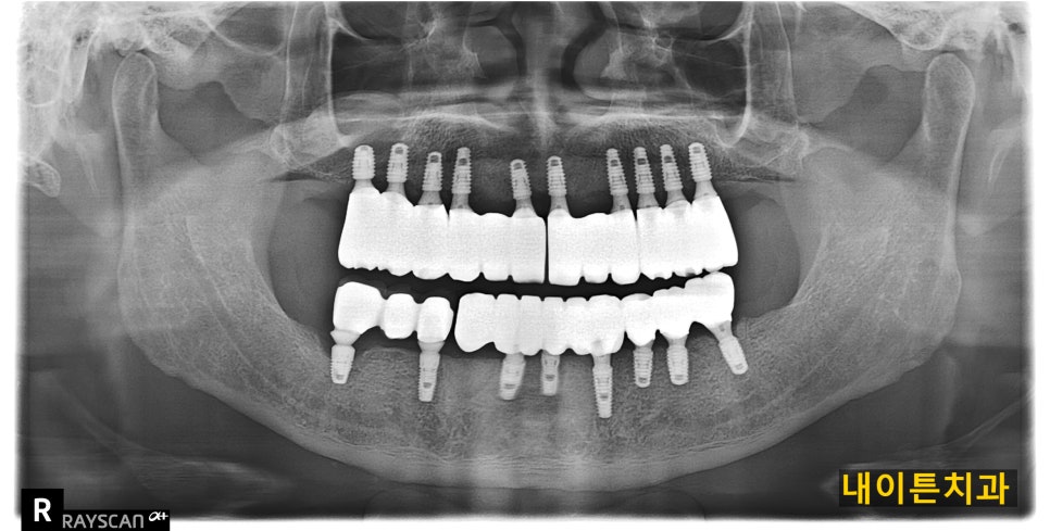 Treatment case image 7