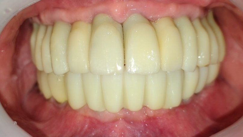 Treatment case image 8