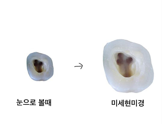 Treatment case image 3