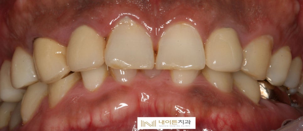 Treatment case image 1