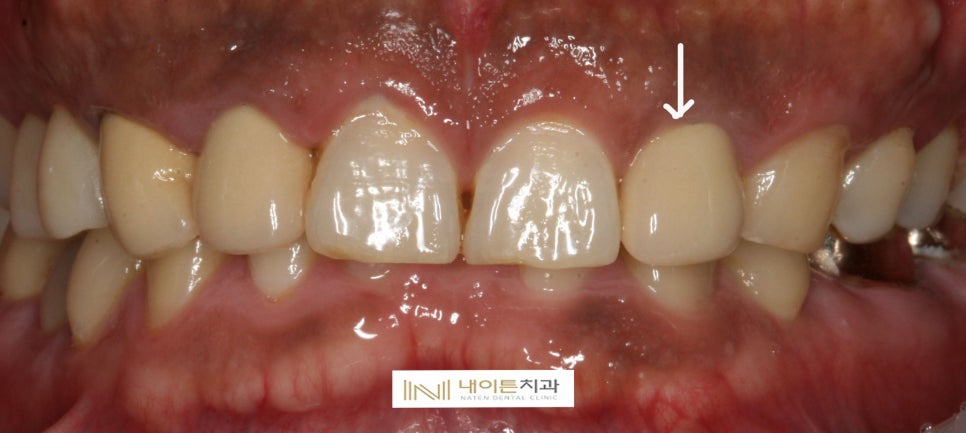 Treatment case image 2