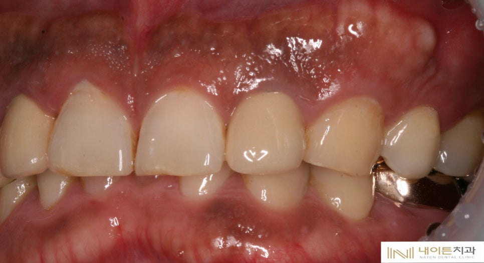 Treatment case image 4