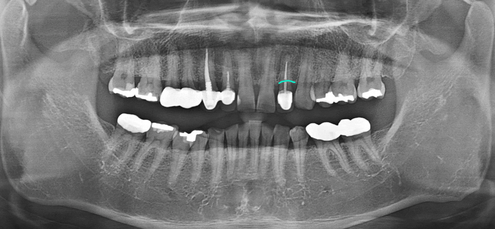 Treatment case image 5