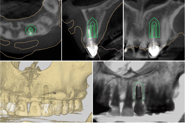 Treatment case image 6