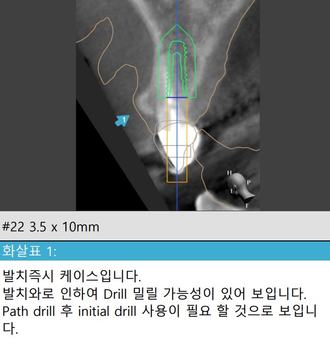 Treatment case image 8