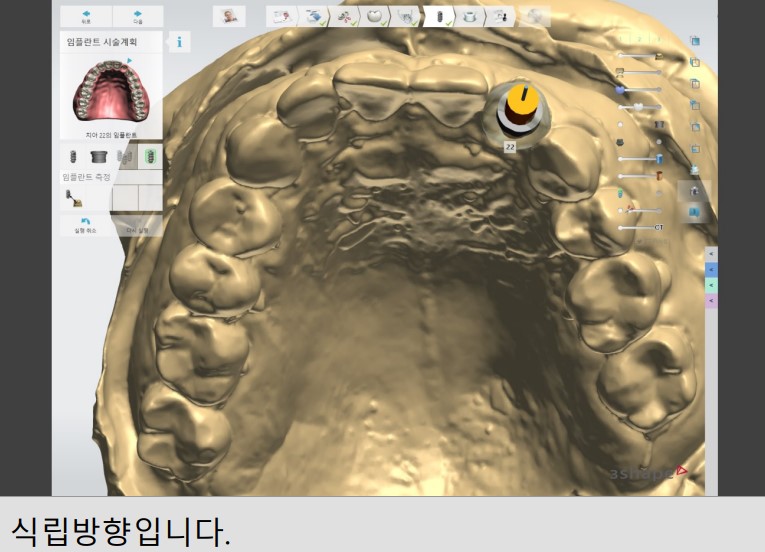 Treatment case image 9