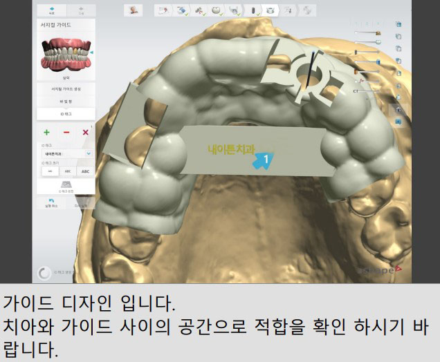 Treatment case image 10