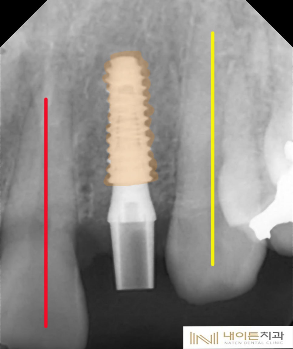 Treatment case image 12