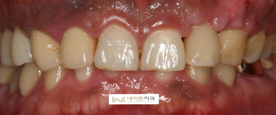 Treatment case image 13