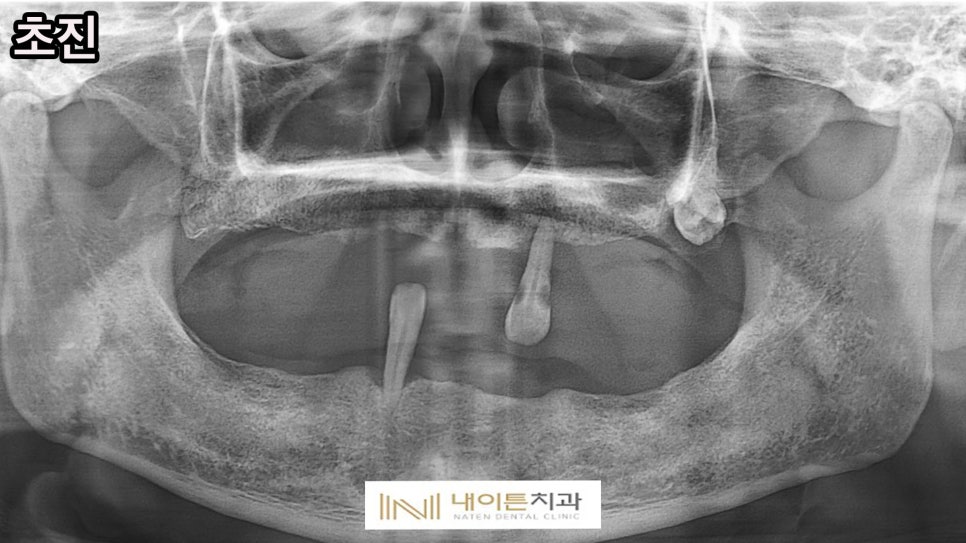 Treatment case image 1