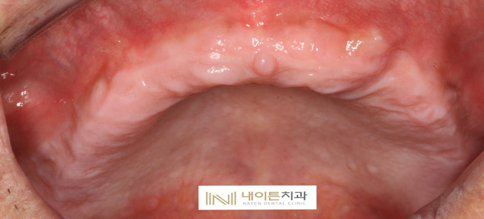 Treatment case image 3