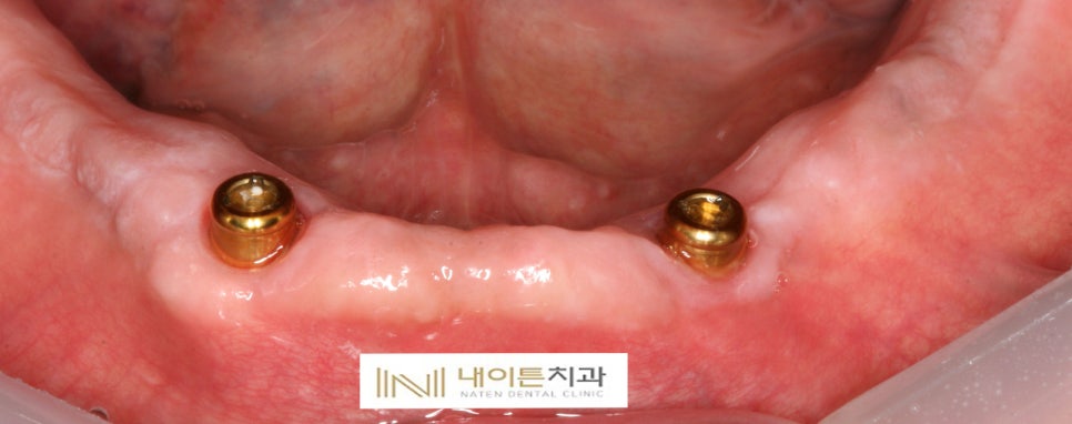 Treatment case image 8