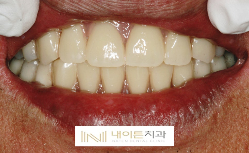 Treatment case image 10