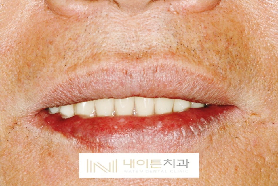 Treatment case image 11