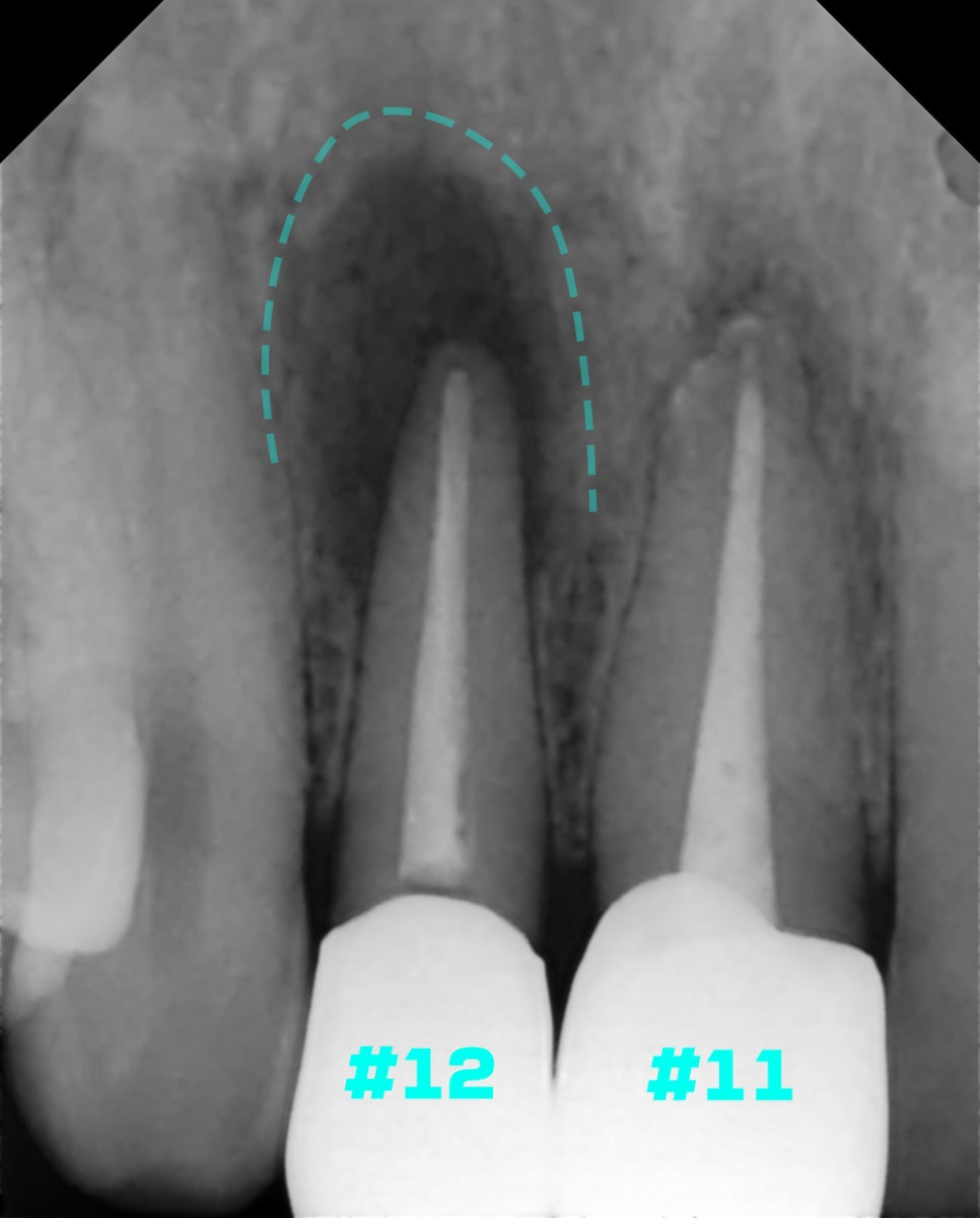 Treatment case image 1