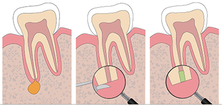Treatment case image 3